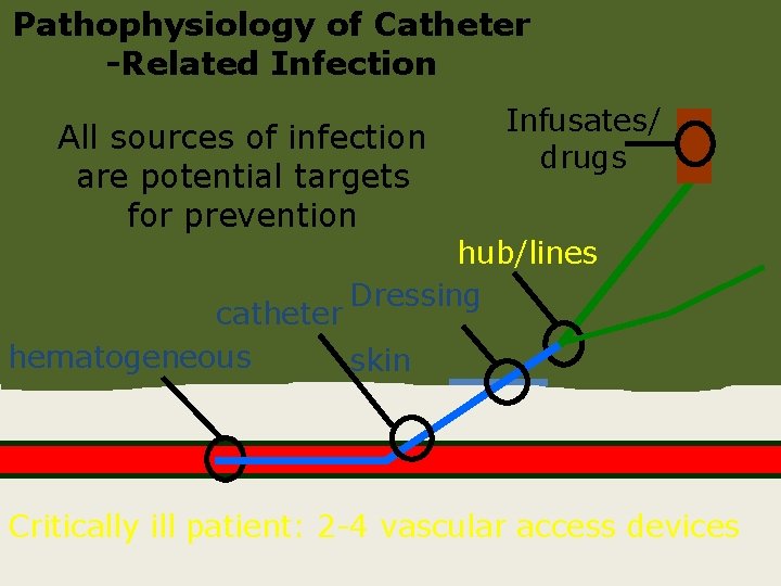 Pathophysiology of Catheter -Related Infection All sources of infection are potential targets for prevention