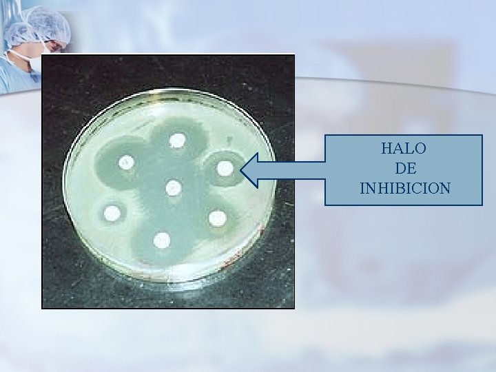 HALO DE INHIBICION 