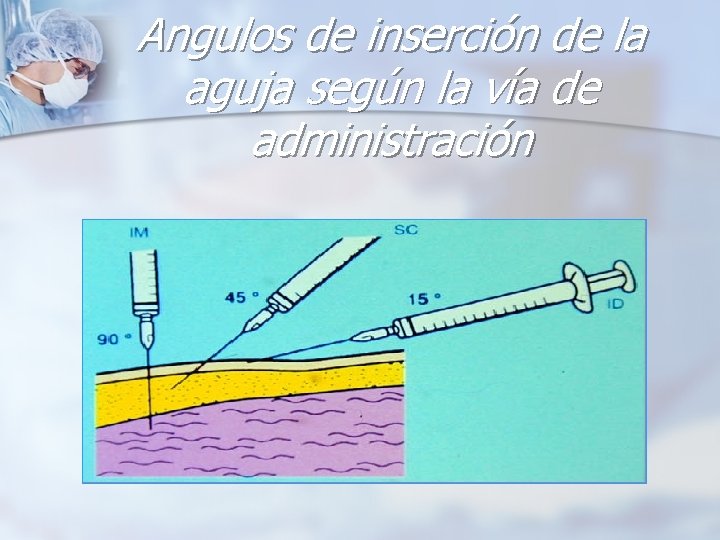 Angulos de inserción de la aguja según la vía de administración 