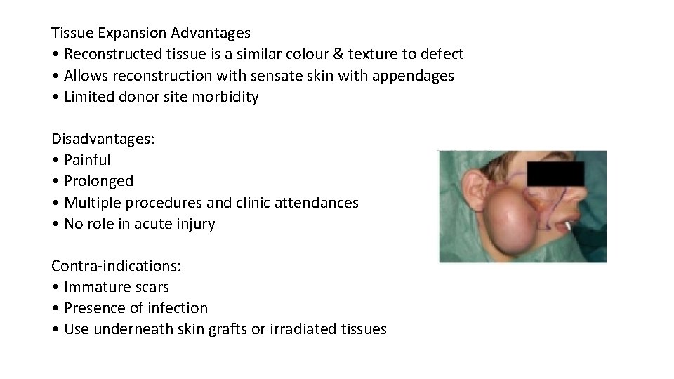 Tissue Expansion Advantages • Reconstructed tissue is a similar colour & texture to defect