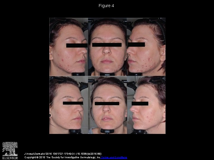 Figure 4 J Invest Dermatol 2015 1351727 -1734 DOI: (10. 1038/jid. 2015. 89) Copyright