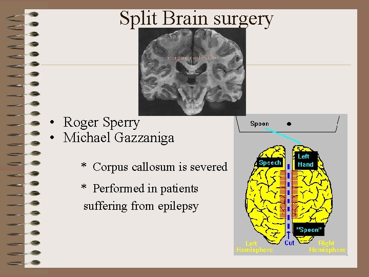 Split Brain surgery • Roger Sperry • Michael Gazzaniga * Corpus callosum is severed