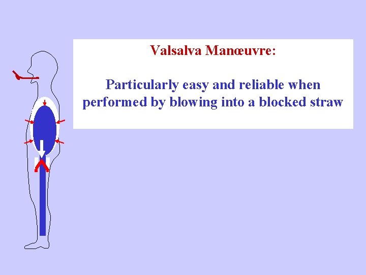 Valsalva Manœuvre: Particularly easy and reliable when performed by blowing into a blocked straw