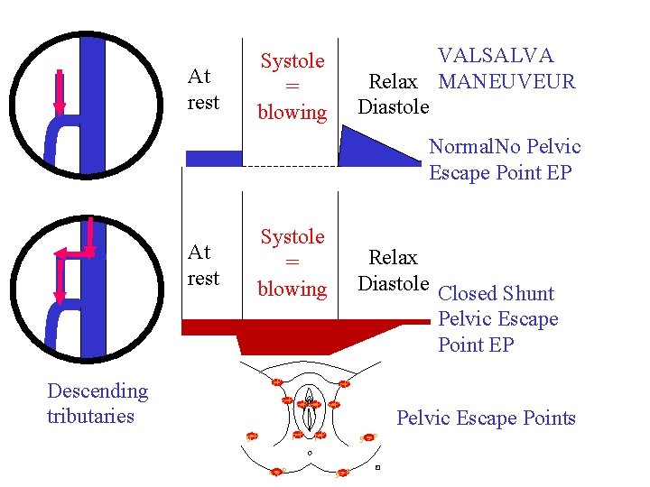 At rest VALSALVA Relax MANEUVEUR Diastole Systole = blowing Normal. No Pelvic Escape Point