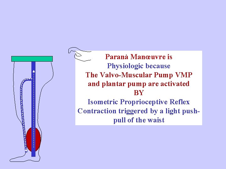 Paranà Manœuvre is Physiologic because The Valvo-Muscular Pump VMP and plantar pump are activated