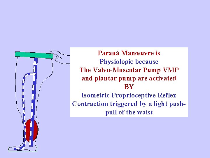 Paranà Manœuvre is Physiologic because The Valvo-Muscular Pump VMP and plantar pump are activated
