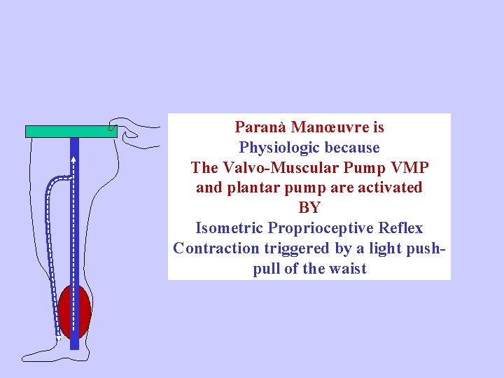 Paranà Manœuvre is Physiologic because The Valvo-Muscular Pump VMP and plantar pump are activated