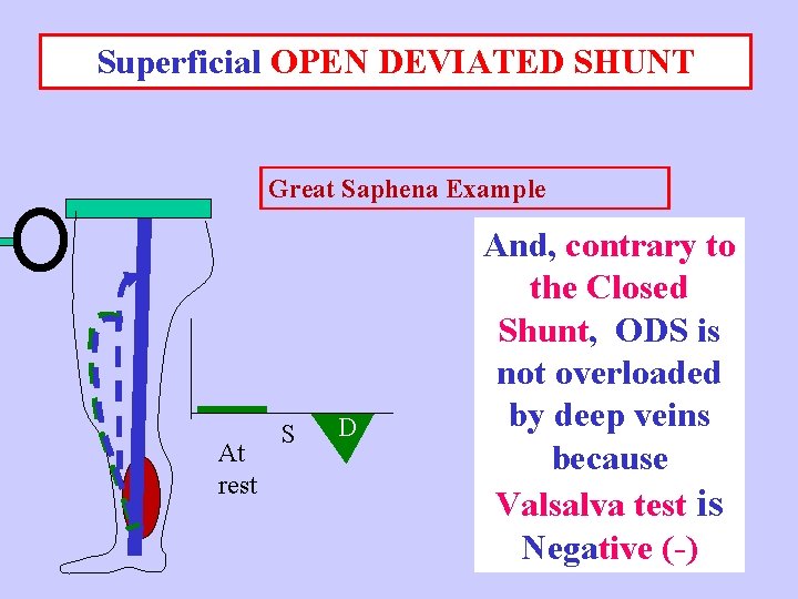 Superficial OPEN DEVIATED SHUNT Great Saphena Example At rest S D And, contrary to