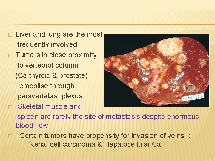 � � Liver and lung are the most frequently involved Tumors in close proximity
