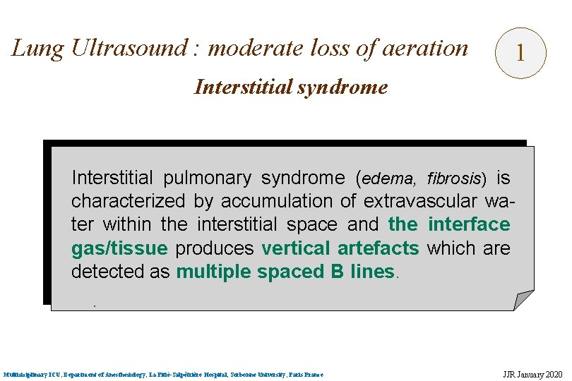 Lung Ultrasound : moderate loss of aeration 1 Interstitial syndrome Interstitial pulmonary syndrome (edema,