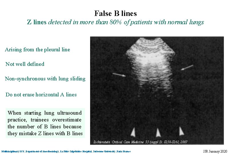 False B lines Z lines detected in more than 80% of patients with normal