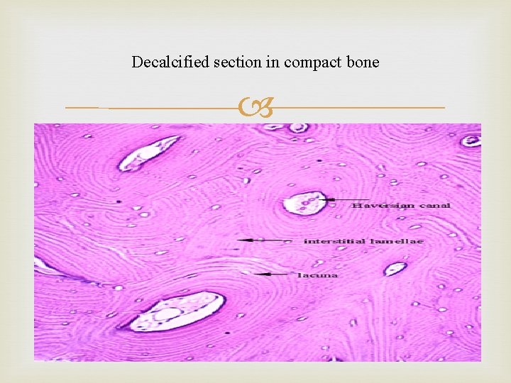 Decalcified section in compact bone 