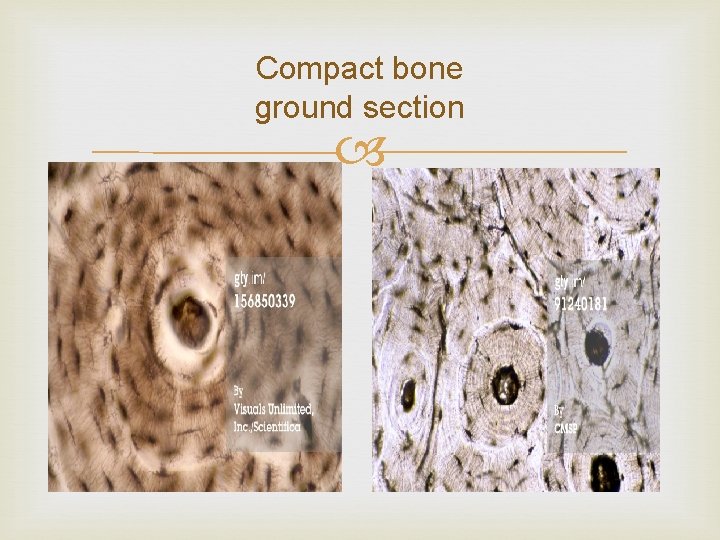 Compact bone ground section 