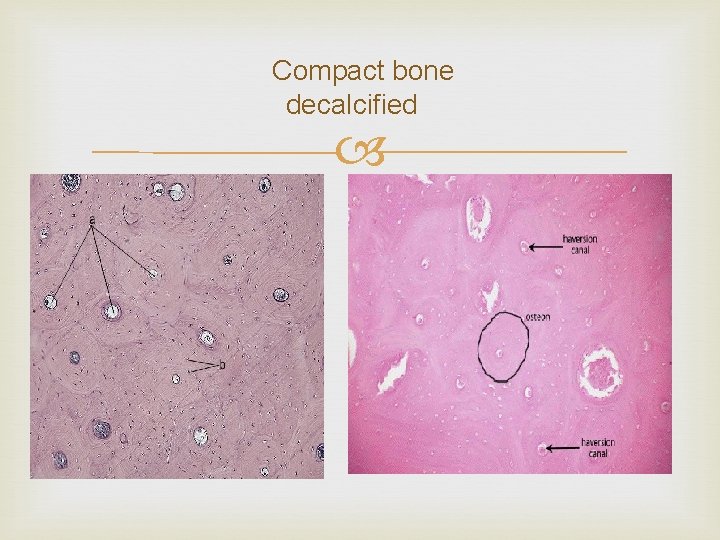 Compact bone decalcified 