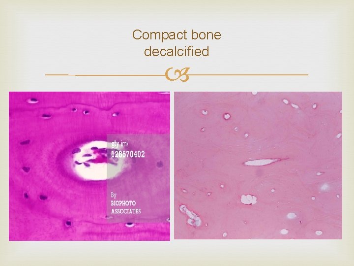 Compact bone decalcified 