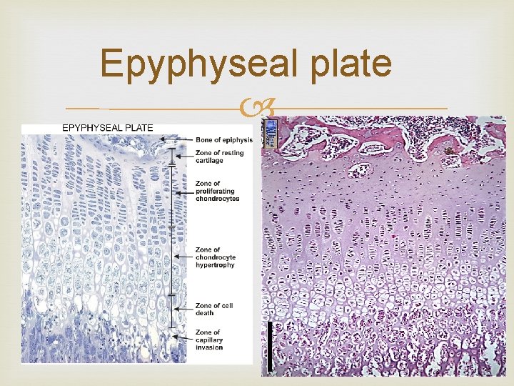 Epyphyseal plate 