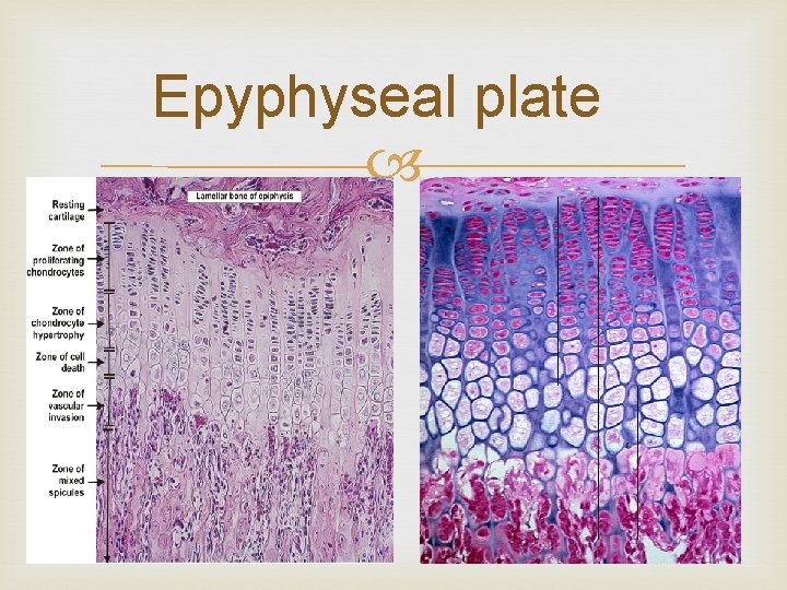 Epyphyseal plate 