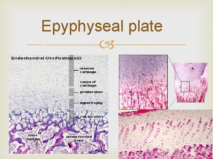 Epyphyseal plate 