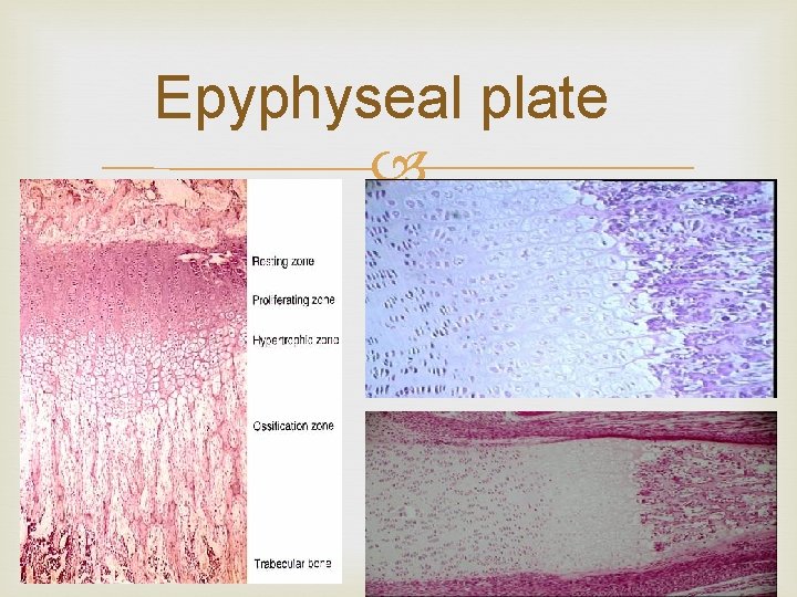 Epyphyseal plate 