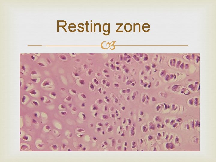 Resting zone 