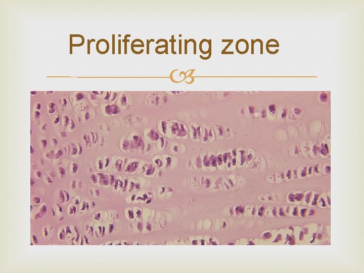 Proliferating zone 