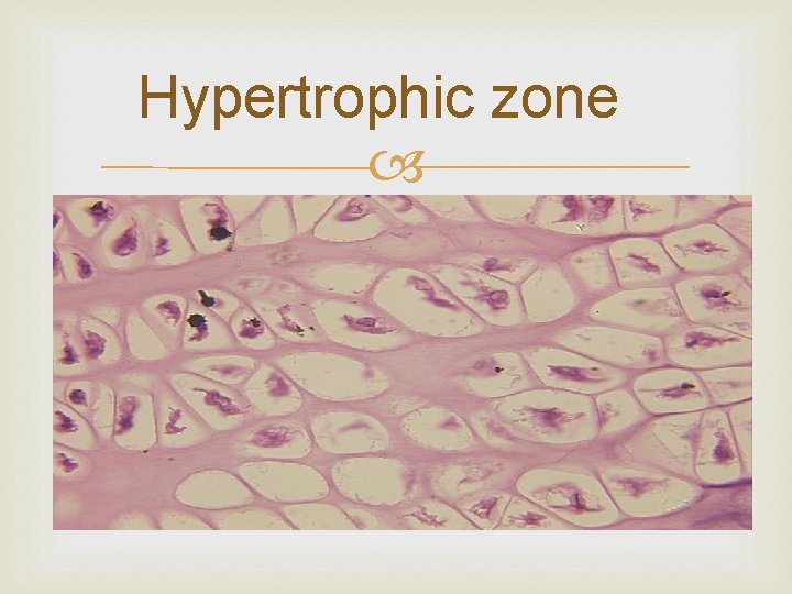 Hypertrophic zone 