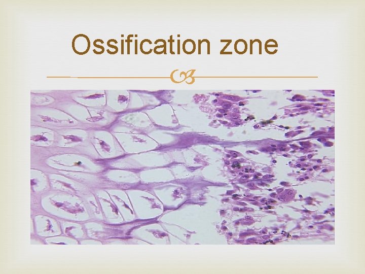 Ossification zone 