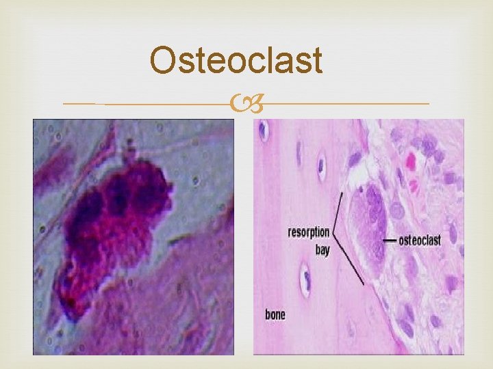 Osteoclast 