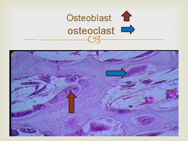 Osteoblast osteoclast 