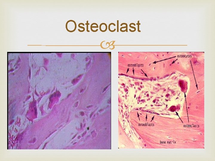 Osteoclast 