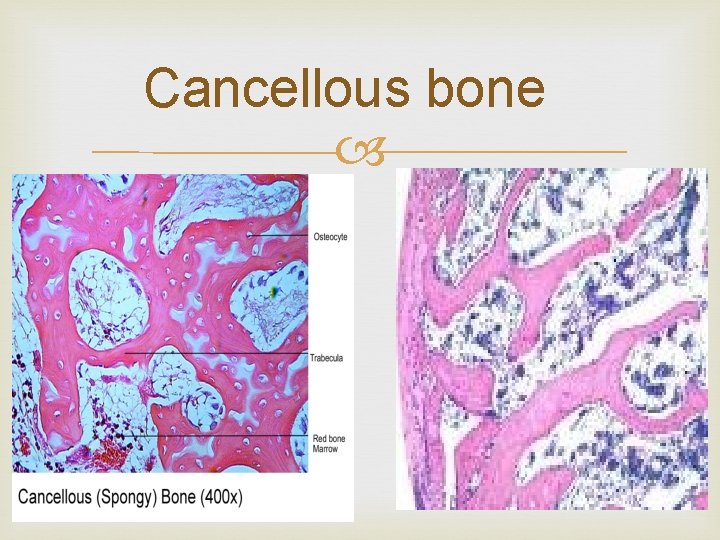Cancellous bone 