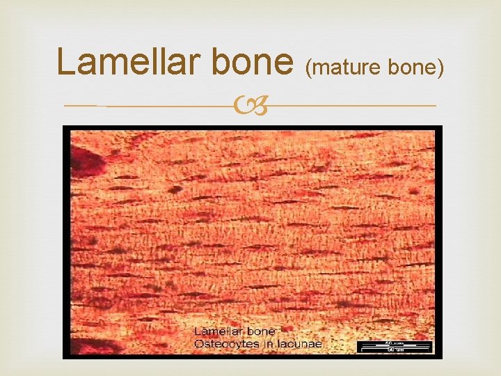 Lamellar bone (mature bone) 