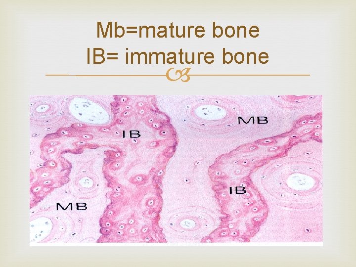Mb=mature bone IB= immature bone 