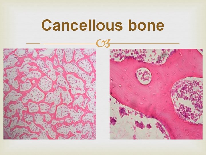 Cancellous bone 