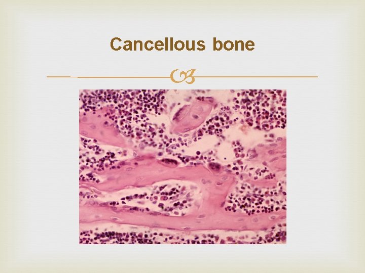 Cancellous bone 