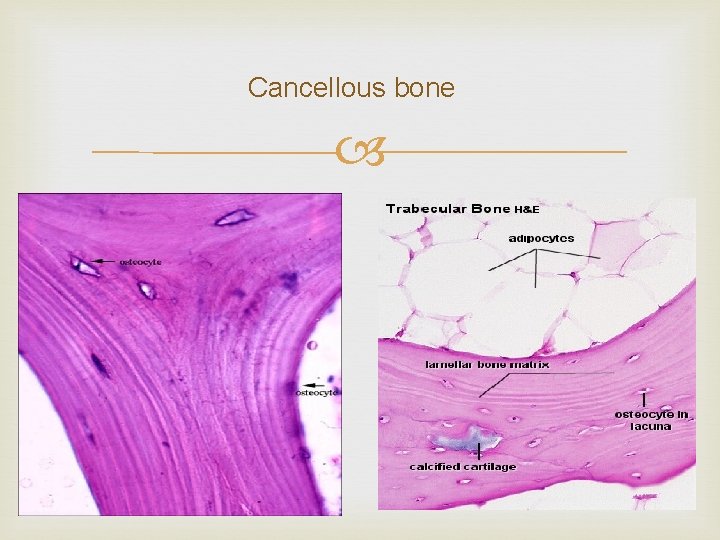 Cancellous bone 