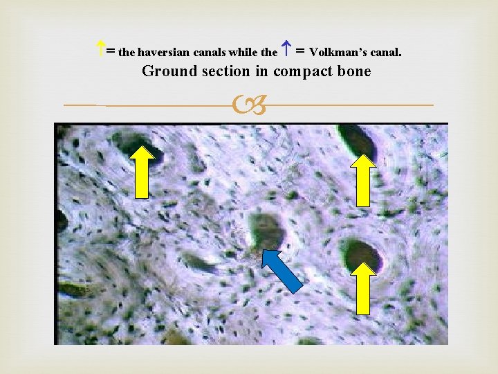  = the haversian canals while the = Volkman’s canal. Ground section in compact