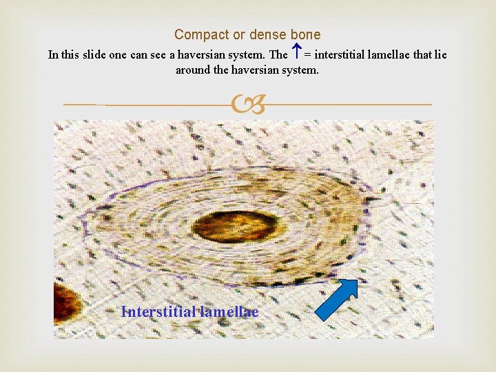 Compact or dense bone In this slide one can see a haversian system. The