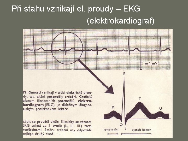 Při stahu vznikají el. proudy – EKG (elektrokardiograf) 