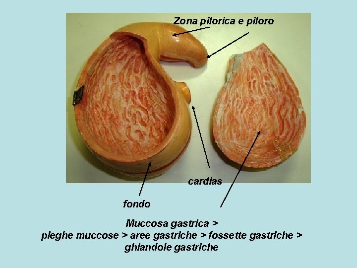 Zona pilorica e piloro cardias fondo Muccosa gastrica > pieghe muccose > aree gastriche