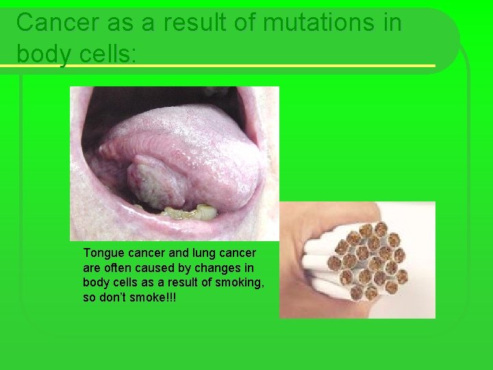 Cancer as a result of mutations in body cells: Tongue cancer and lung cancer