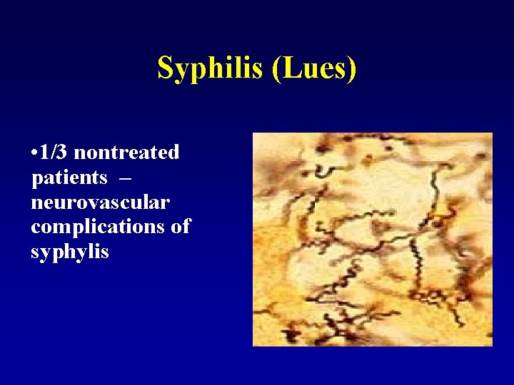 Syphilis (Lues) • 1/3 nontreated patients – neurovascular complications of syphylis 