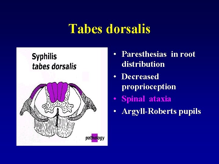 Tabes dorsalis • Paresthesias in root distribution • Decreased proprioception • Spinal ataxia •