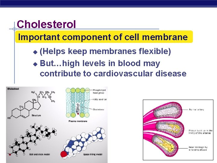 Cholesterol Important component of cell membrane (Helps keep membranes flexible) u But…high levels in