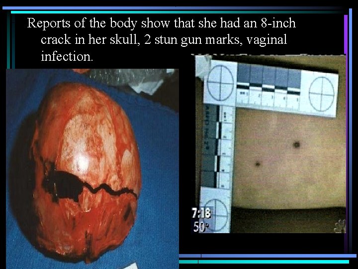 Reports of the body show that she had an 8 -inch crack in her