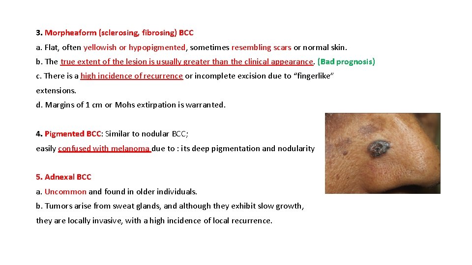 3. Morpheaform (sclerosing, fibrosing) BCC a. Flat, often yellowish or hypopigmented, sometimes resembling scars