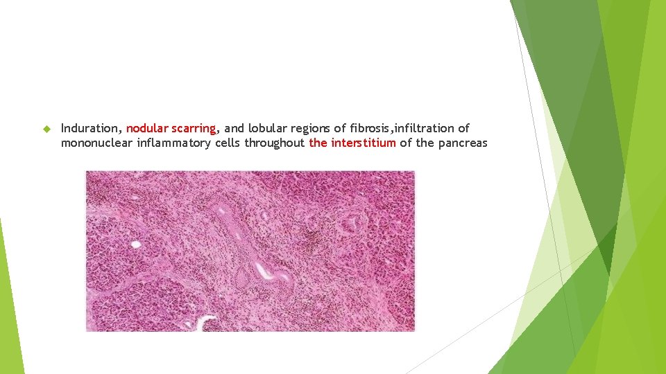  Induration, nodular scarring, and lobular regions of fibrosis, infiltration of mononuclear inflammatory cells