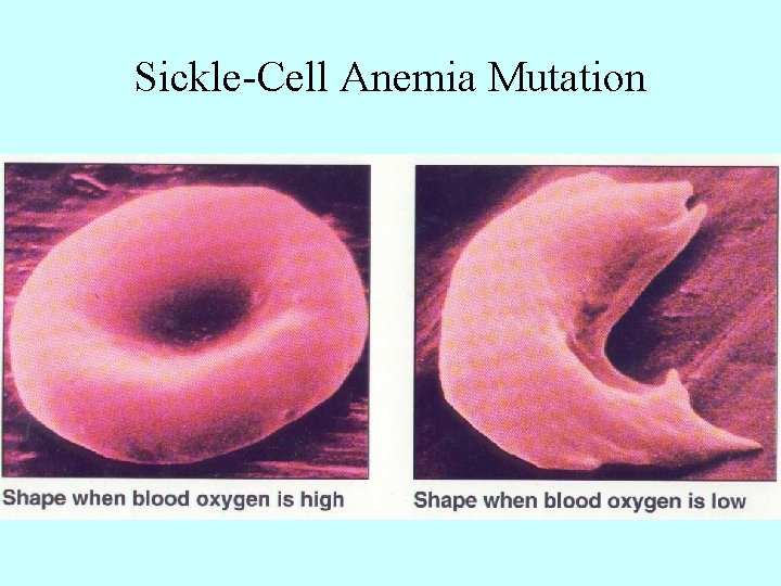 Sickle-Cell Anemia Mutation 