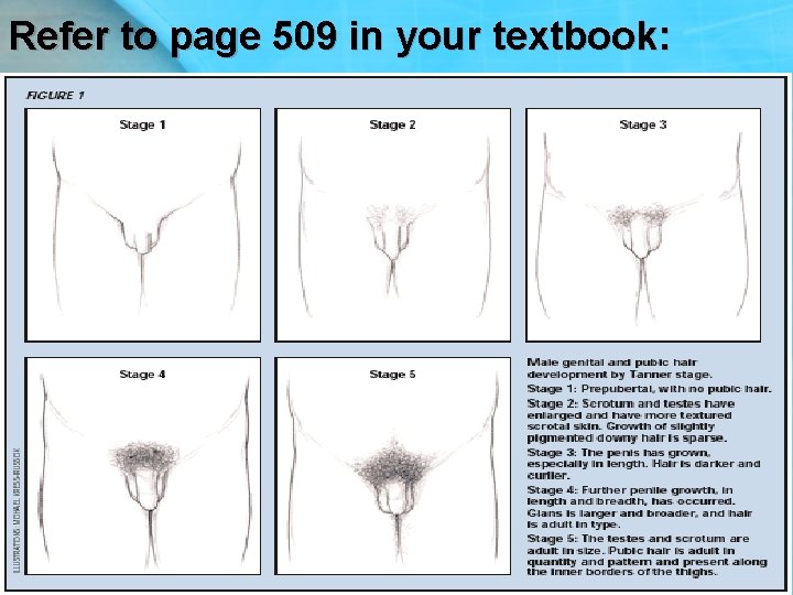 Refer to page 509 in your textbook: 