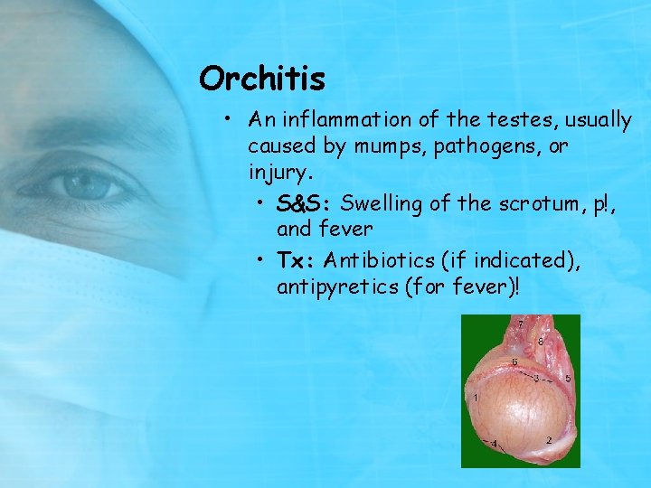 Orchitis • An inflammation of the testes, usually caused by mumps, pathogens, or injury.